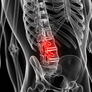 Spine Injuries